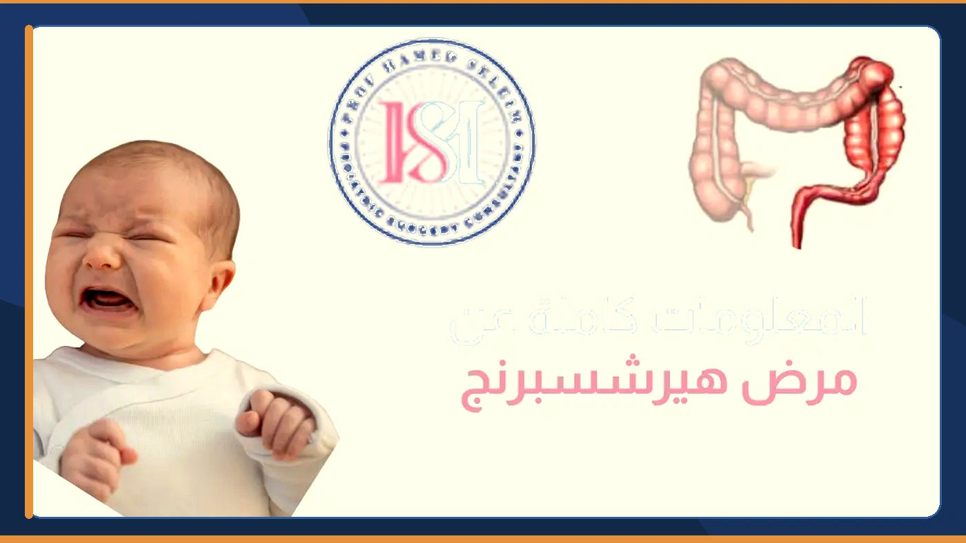 المعلومات الكاملة عن مرض هيرشسبرنج أو اعتلال القولون عند الأطفال