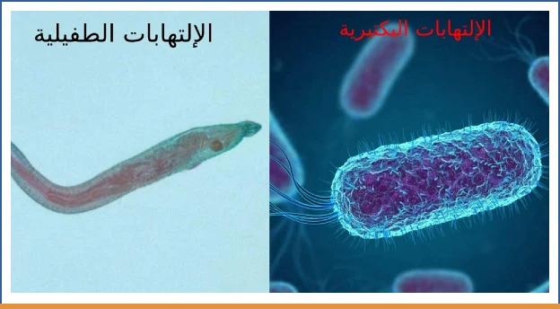الإلتهابات البكتيرية والطفيلية