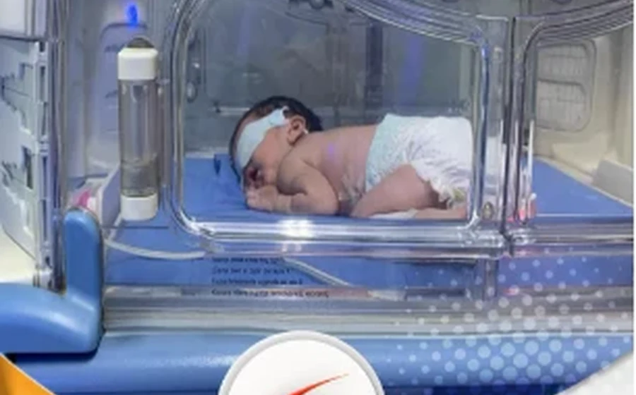 عملية إنقاذ طفل عمره ثلاث سنوات من نزيف شديد في الأمعاء